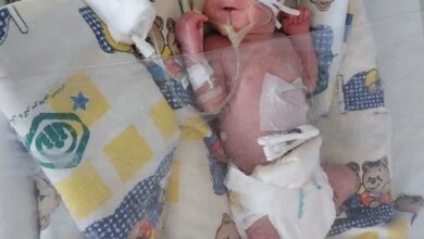 تولد معجزه آسا در بیمارستان NICU بیمارستان شریرات در اصفهان