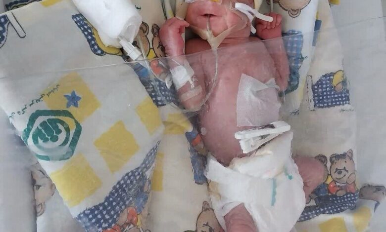 تولد معجزه آسا در بیمارستان NICU بیمارستان شریرات در اصفهان