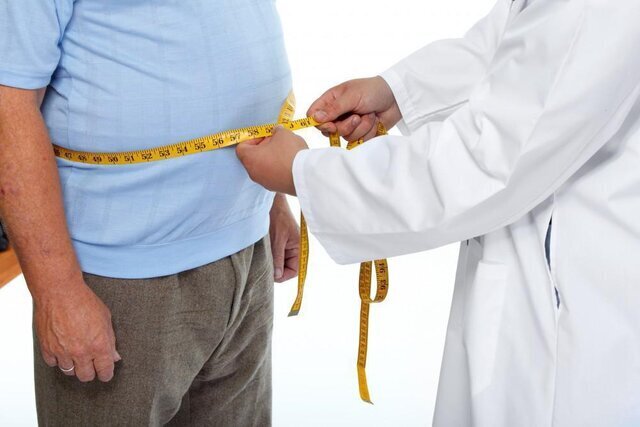 شاخص مهم BMI برای جراحی لاغری/ نحوه محاسبه؟