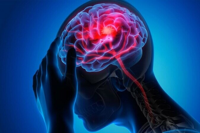 عادتهای مضر برای سلامت مغز