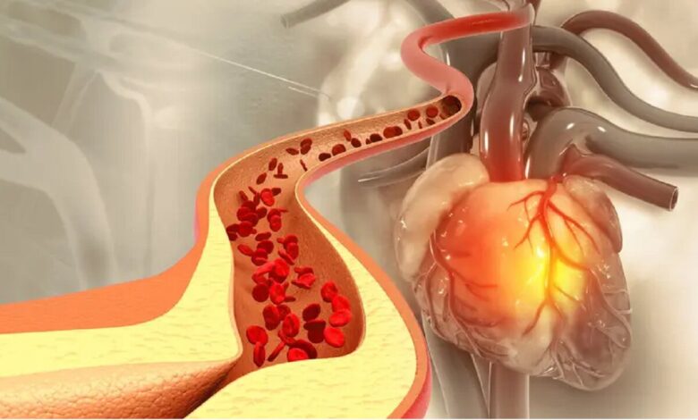 این پنج غذا به طور طبیعی کلسترول بد را کاهش می دهند