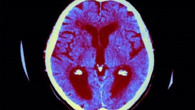 فراموشی زود هنگام در کودکان ؛ پای سرب در وسط است - خبرگزاری مهر | اخبار ایرانی و جهانی