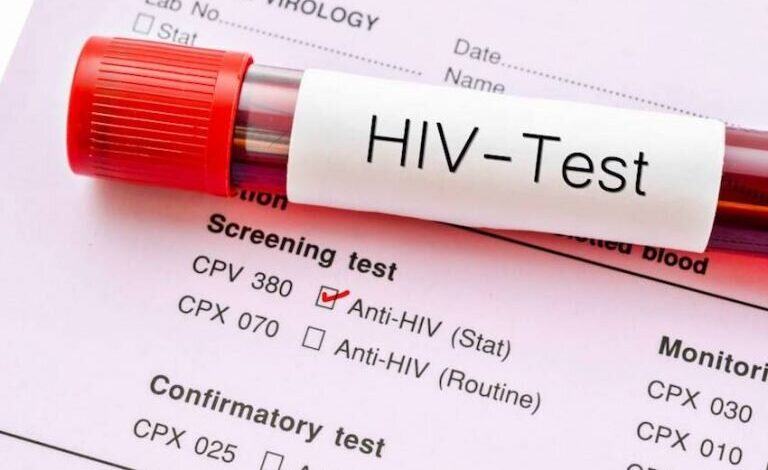 داروی جدید پیشگیری از HIV تأیید FDA را دریافت کرد