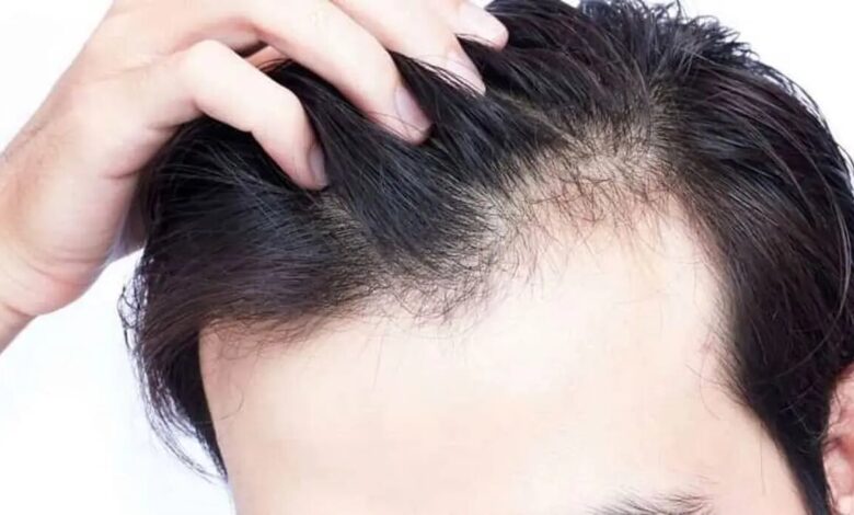 با چند غذای ساده از مو مراقبت کنید