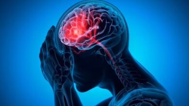 علائم خونریزی مغزی چیست؟ - اخبار آنلاین