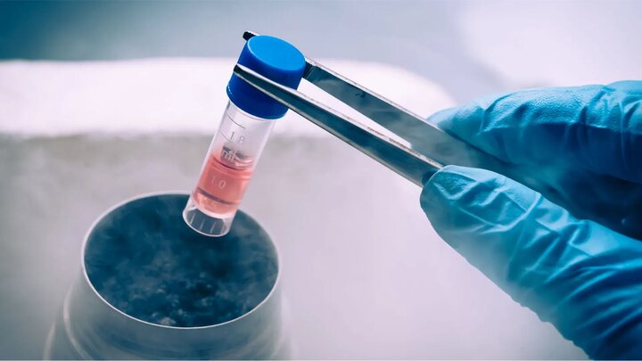 انجماد تخم مرغ ؛ پلی بین حال و بارداری ایمن در آینده
