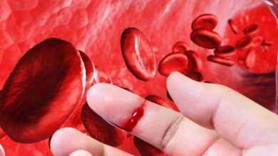 با هموفیلی بیشتری آشنا شوید ، از علائم گرفته تا کنترل بیماری - آژانس خبری مهر | اخبار ایرانی و جهانی