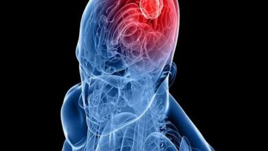 آلودگی هوا با تومورهای مشترک مغز همراه است - آژانس خبری مهر | اخبار ایرانی و جهانی