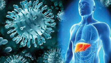 درمان این بیماری رایگان است