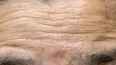 مکانیسم چین و چروک پوست با افزایش سن کشف شد