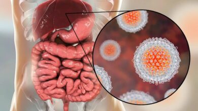 بیماران هپاتیت C در ایران اعلام شدند - خبرگزاری مهر | اخبار ایرانی و جهانی