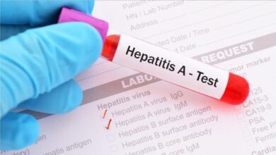 5 ٪ از بیماران HIV تحت نظارت قرار گرفته است