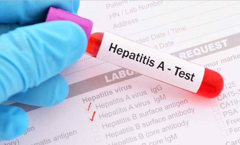 5 ٪ از بیماران HIV تحت نظارت قرار گرفته است