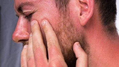 آفتاب سوختگی از مشکلات پیاده روی مشترک Arbaeen