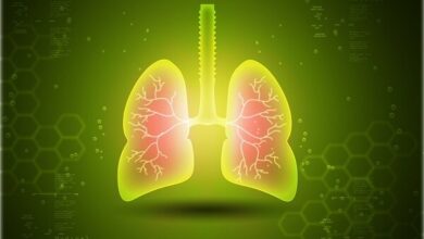 قالب خانگی می تواند باعث بیماری ریه شود - خبرگزاری مهر | اخبار ایرانی و جهانی