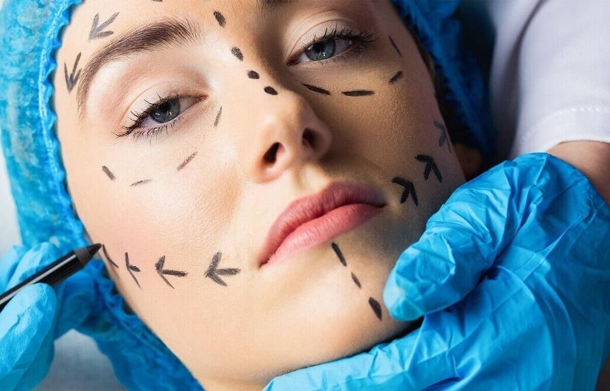 جراحی زیبایی در ایران ؛ از عدم موفقیت پزشکی به ضرورت نظارت/ 