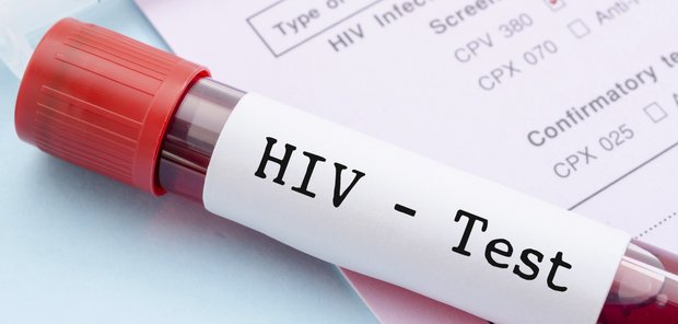 خال کوبی دروازه ورودی HIV