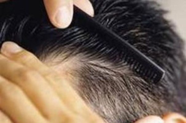 راهکارهای پزشکی ایرانی برای تقویت مو ؛ یک تجربه طبیعی و کم - آژانس خبری Mehr | اخبار ایرانی و جهانی