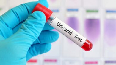 علائم افزایش سطح اسید اوریک در بدن چیست؟