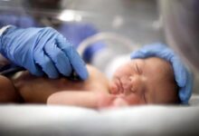 نخستین مشاور هوشمند ناباروری با کمک هوش مصنوعی رونمایی شد