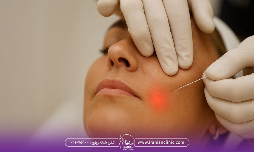 بهترین کلینیک Andalift در تهران کجاست؟