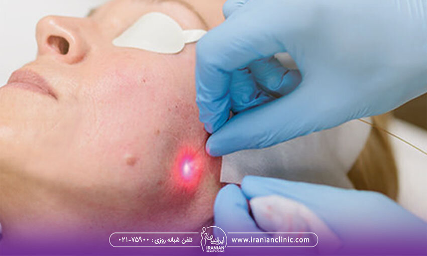 بهترین کلینیک Andalift در تهران کجاست؟