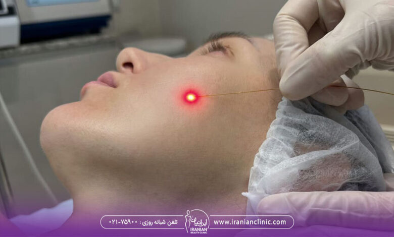 بهترین کلینیک Andalift در تهران کجاست؟