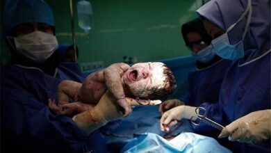 بیمارستان ها باید بخش سزارین را کاهش دهند - آژانس خبری مهر | اخبار ایرانی و جهانی