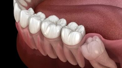 رابطه بین بهداشت دهان و دندان ضعیف و مشکلات بهداشتی مزمن - آژانس خبری مهر | اخبار ایرانی و جهانی