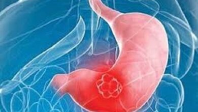 5 ٪ از سرطانهای معده ناشی از این باکتری - آژانس خبری مهر | اخبار ایرانی و جهانی