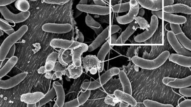 علائم هشدار در مورد وبا را مشخص کنید