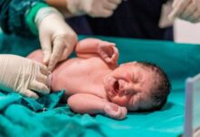 زایمان طبیعی بدون درد؛ تولدی آرام برای مادر و نوزاد