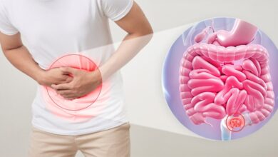 درمان فوری یبوست در مسافرت/ استفاده موقت از این داروهای گیاهی/ خوردن غذاهای آبکی و عراق بیشتر.