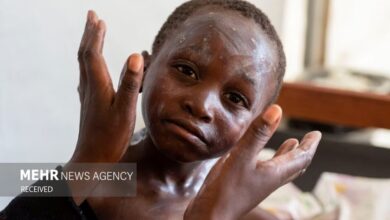 تعداد بیماری میمون Smolt در آفریقا بیش از 3 - آژانس خبری Mehr | اخبار ایرانی و جهانی