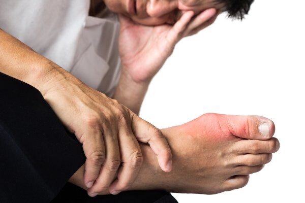 چگونه سطح اسید اوریک بدن را کاهش دهیم؟