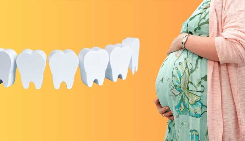 کاشت دندان در بارداری ؛ آیا ممکن است؟