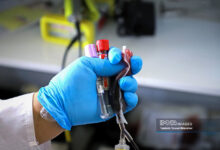 رشد بیش از 5 ٪ از اهدای خون زنان در شش ماه اول سال جاری