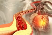 ادویه ای که کلسترول خون را پایین می آورد