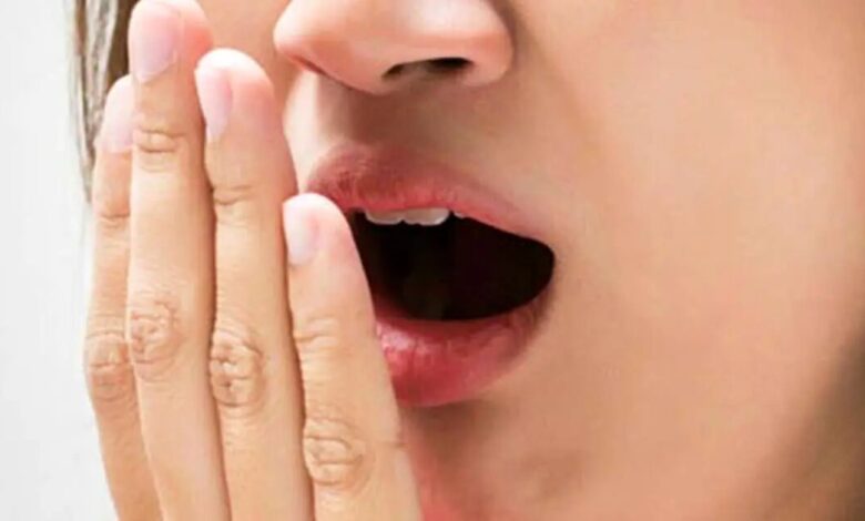 سفید روی زبان چیست؟