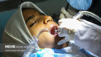 آدامس بدون شکر برای تسکین بوی بد دهان - آژانس خبری مهر | اخبار ایرانی و جهانی