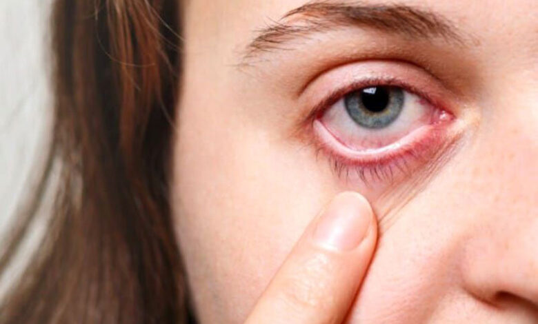آیا چشم هم سکته می کند؟ - اخبار آنلاین
