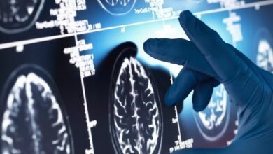 یک داروی گیاهی مفید علیه آلزایمر