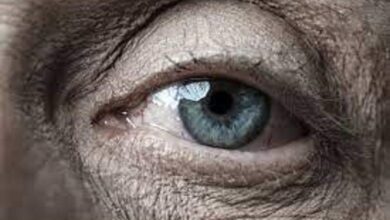 تخلف در تبلیغات قطره ای از راه حل / خطر پارگی شبکیه یکی از عوارض این قطره ها است