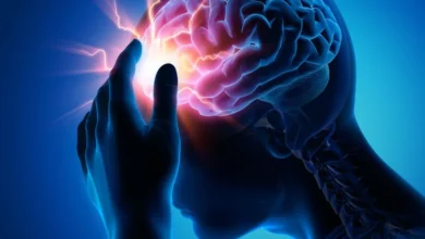 طوفان مغزی - بیمارستان بهداشت فردا