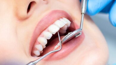 ریفلاکس معده ؛ یک عامل کمتر شناخته شده از پوسیدگی دندان