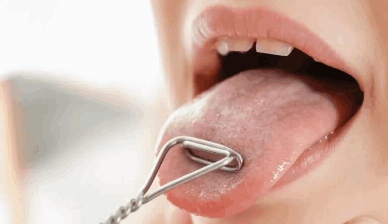 علائم هشدار دهنده سرطان زبان چیست؟