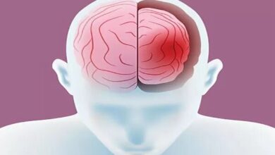 چه کسی در معرض خطر انقباض مغز است؟