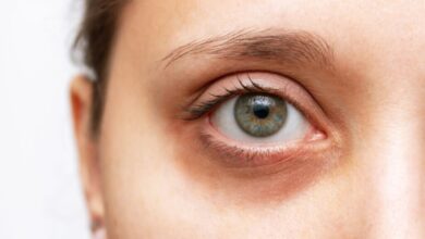 با مصرف این ویتامین ها تاریکی چشم ها را حل کنید