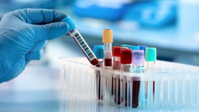 رونمایی از ۳ محصول تخصصی خون