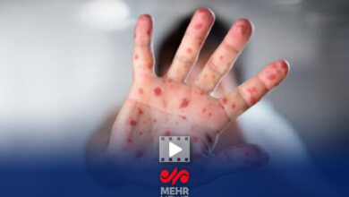 سرخک و سرخچه را در ایران بردارید. افتخار در سایه همسایگی با بیماری ها